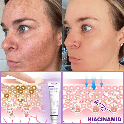 Vitalisys® 🍅 Crema Corporal con Rodillo de PDRN y Multi-Péptidos: Antiedad, Hidratación, Reafirmación, Reparación de la Piel, Tono Uniforme, Tratamiento de Acné y Manchas, Reducción de Verrugas y Lunares, y Alivio de la Psoriasis.