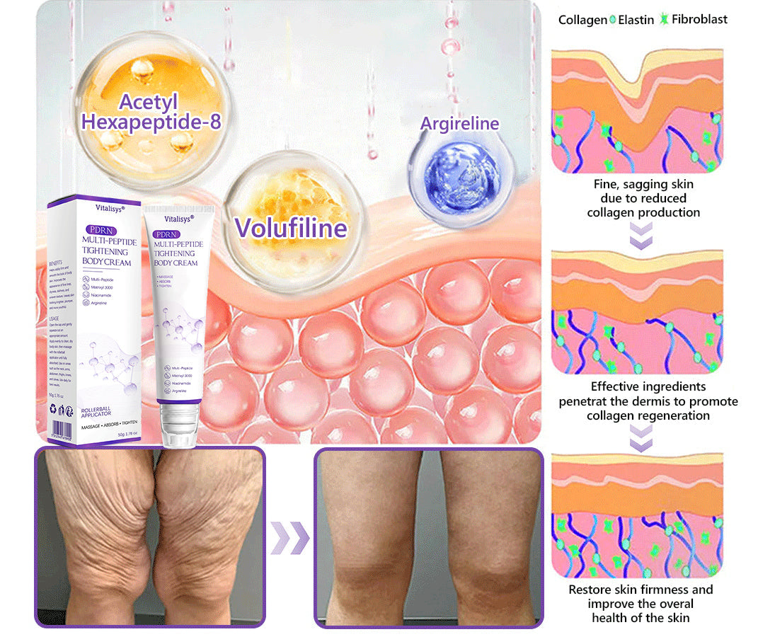 Vitalisys® 🍅 Crema Corporal con Rodillo de PDRN y Multi-Péptidos: Antiedad, Hidratación, Reafirmación, Reparación de la Piel, Tono Uniforme, Tratamiento de Acné y Manchas, Reducción de Verrugas y Lunares, y Alivio de la Psoriasis.