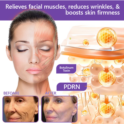 Vitalisys® 🍅 Crema Corporal con Rodillo de PDRN y Multi-Péptidos: Antiedad, Hidratación, Reafirmación, Reparación de la Piel, Tono Uniforme, Tratamiento de Acné y Manchas, Reducción de Verrugas y Lunares, y Alivio de la Psoriasis.