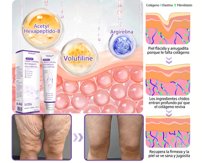30% de descuento exclusivo: Vitalisys® 💎💎 Crema Corporal con Rodillo PDRN y Multi-Péptidos: Antiedad, Hidratación, Reafirmación, Reparación de la Piel, Tono Uniforme, Tratamiento de Manchas y Acné, Reducción de Verrugas y Lunares.