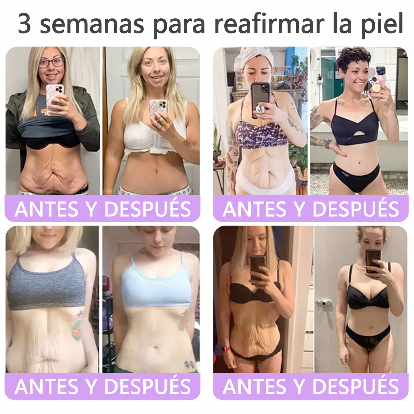 30% de descuento exclusivo: Vitalisys® 💎💎 Crema Corporal con Rodillo PDRN y Multi-Péptidos: Antiedad, Hidratación, Reafirmación, Reparación de la Piel, Tono Uniforme, Tratamiento de Manchas y Acné, Reducción de Verrugas y Lunares.