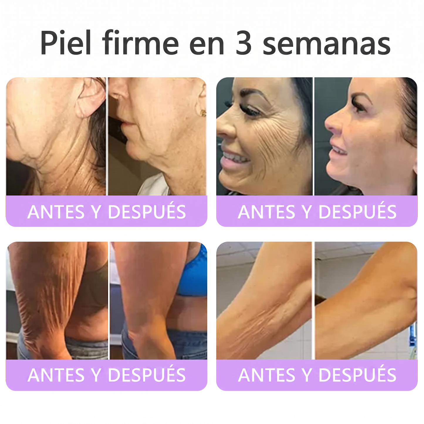 30% de descuento exclusivo: Vitalisys® 💎💎 Crema Corporal con Rodillo PDRN y Multi-Péptidos: Antiedad, Hidratación, Reafirmación, Reparación de la Piel, Tono Uniforme, Tratamiento de Manchas y Acné, Reducción de Verrugas y Lunares.