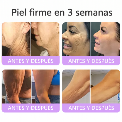 30% de descuento exclusivo: Vitalisys® 💎💎 Crema Corporal con Rodillo PDRN y Multi-Péptidos: Antiedad, Hidratación, Reafirmación, Reparación de la Piel, Tono Uniforme, Tratamiento de Manchas y Acné, Reducción de Verrugas y Lunares.
