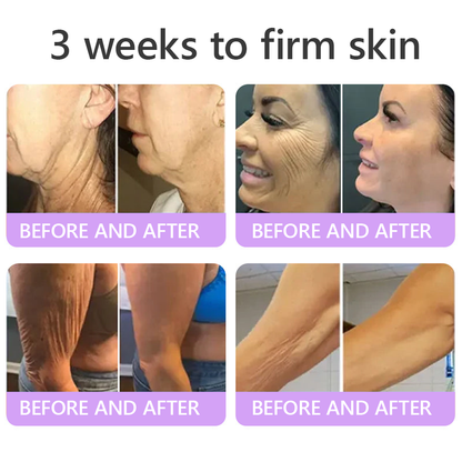Vitalisys® 🍅 Crema Corporal con Rodillo de PDRN y Multi-Péptidos: Antiedad, Hidratación, Reafirmación, Reparación de la Piel, Tono Uniforme, Tratamiento de Acné y Manchas, Reducción de Verrugas y Lunares, y Alivio de la Psoriasis.